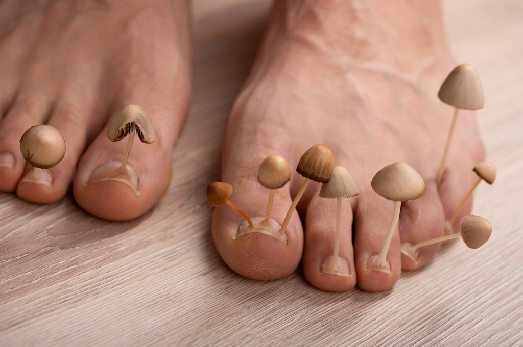 Anti-fungal Shoe and Linen Treatment Sprays