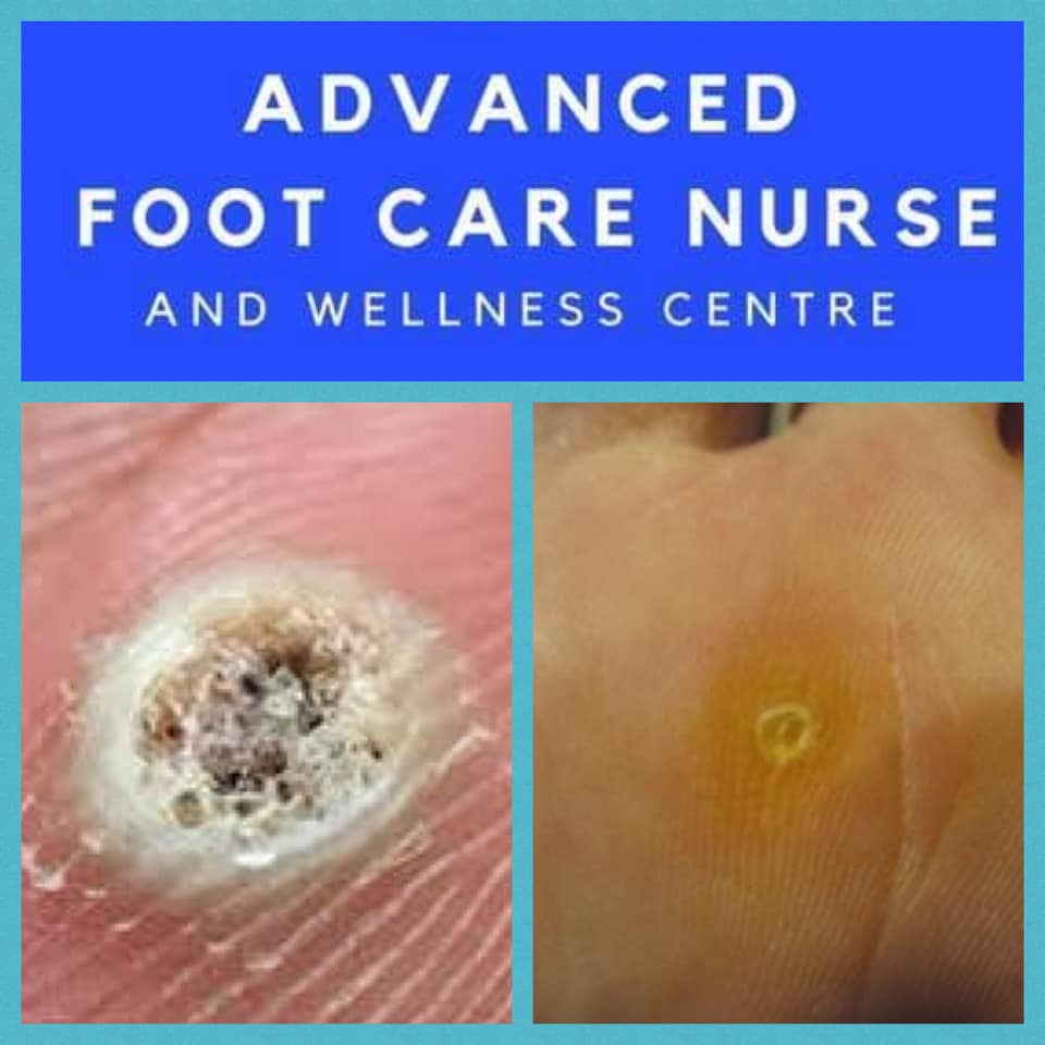 Foot Care Services Payment/ Gift Card Redemption